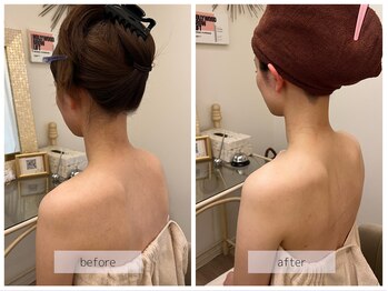 リバース 大阪店(Rebirth)/体重変動なしでも印象は変わる!