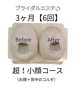 エイミー(Amy)の写真/小顔コルギ&背中コルギで肩甲骨周り、首肩、二の腕、デコルテまですっきり!駆け込みOK◎