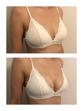 ミント(M’int)/授乳後のバストを戻したい方