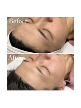 ホワイトワックス 京都四条烏丸(WHITE WAX)/生え際もお任せください^ ^