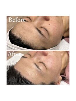 ホワイトワックス 京都四条烏丸(WHITE WAX)/生え際もお任せください^ ^