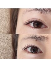 デイジー(DAY'S EYE)/エクパ