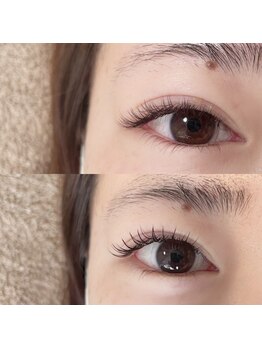 デイジー(DAY'S EYE)/エクパ