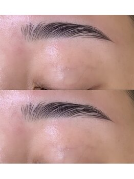 アコ バイ ネオリーブアイス(aco by Neolive ice)/ハリウッドブロウリフト