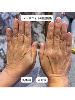 リリー(LILY)/ハンドフォト