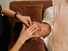 シン(SHINE)/美容鍼灸