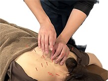 はな鍼灸院 接骨院