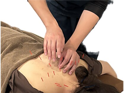 はな鍼灸院 接骨院の写真