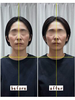 シンシンラボ 豪徳寺(SHINSHIN Lab)/筋肉の緊張をほどく