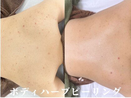 レイ(Lei)の写真