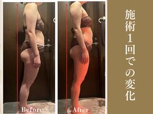 ザ モアナテラス(THE MOANA TERRACE)/施術１回での変化