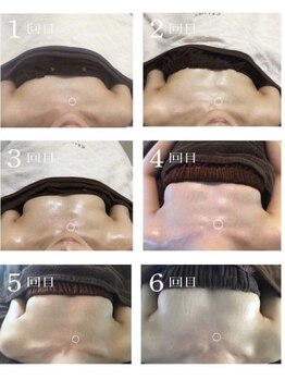 韓国式肌質改善・バストケアサロンKaela【4月 NEW OPEN(予定)】/30代/独身