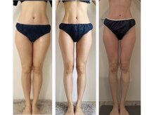 フェムプリュ(femplus)/