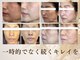 ブルースターの写真