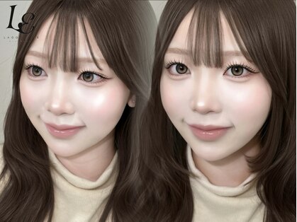 ラグーンアイ(LAGOON EYE)の写真