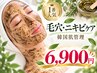 【限定62%off★】ハーブピーリング剥離なし#ニキビ