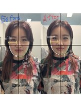 サララ(SALALA)/小顔矯正