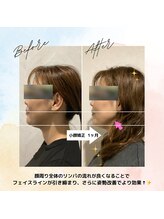 ラクリエ 東加古川院(La Creer)/お客様ビフォーアフター