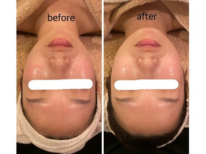うつくし痩身 美サロン ゼットワン(Z-ONE)の写真