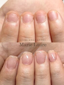 マリーロール 淀屋橋本店(Marie Laure)/自爪育成/深爪矯正/ネイルケア