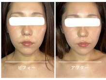 クク 赤坂 天神(99 KUKU)/