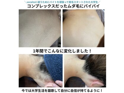 そらいと(soraito)の写真