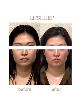 リルシープ(LIL'SHEEP)/