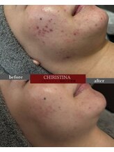 ケア(CARE)/クリスティーナ