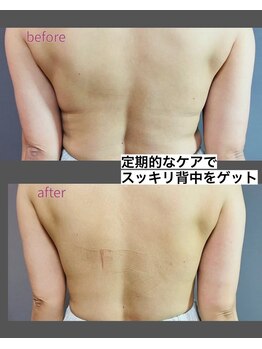 エルア バイ ヘア サロン エスペース(elua by Hair salon espace)/リンパマッサージ