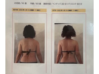 ソレイユ/インディバ30分+バリエステ80分