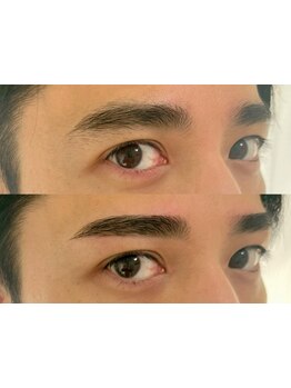 メンズフェイシャル