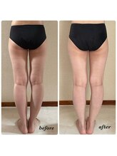 シャルマン(Charmant)/最新機器使用、筋膜リリース