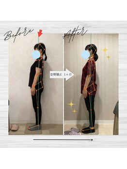 ラクリエ 東加古川院(La Creer)/お客様ビフォーアフター