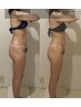 【下半身ダイエット】脂肪燃焼×冷えむくみ改善★最新マシン75分　16000円→
