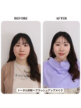 シュアリー(Surely)/トータルコースお客様