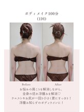 トゥインクル 麻布(twinkle)/南麻布/勝山式美容矯正/小顔矯正