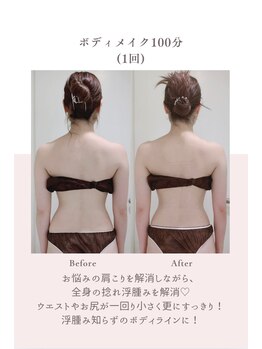 トゥインクル 麻布(twinkle)/南麻布/勝山式美容矯正/小顔矯正