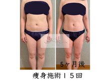 アイ エステサロン(Ai)/【40代】お腹周りが楽になった♪