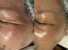 フェリス(FELIZ)/歳を重ねて出来たシワにはコレ！