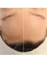 リバージュ(Riverge)/フェイシャルwax