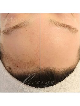 リバージュ(Riverge)/フェイシャルwax