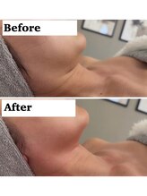 ペルル(Perle)/レッドショット