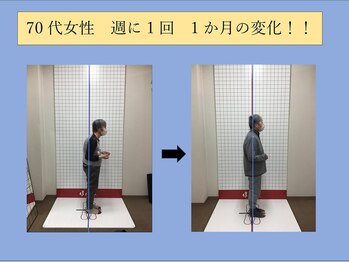 ほねつぎ長嶺鍼灸接骨院/ビフォーアフター6