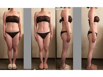 エステアンドネイルサロン ぶらんぶりえ/筋膜セル（90）×脂肪細胞減少