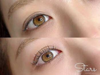 スターズ(Stars)/上下ラッシュリフト