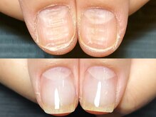 ネイルズパレード(Nails parade.)の雰囲気（自爪育成メニュー。お悩みがある方1度ご相談ください♪        ）