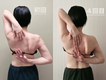 マイティー整骨院 ココア(CoCoa)/肩甲骨洗浄