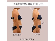 セレンディピティー(Serendipity)の雰囲気（圧倒的結果出し！凝り、姿勢改善で見た目痩せも叶います♪）