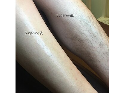 シュガーリングハウスレディ(SugaringHouse LADY)の写真