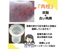 ミスズ(MISUZU)の雰囲気（ごっそり毛穴の大掃除）